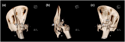 10.1177_2055116915613816-fig3.tif