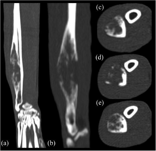 10.1177_2055116919899754-fig2.tif