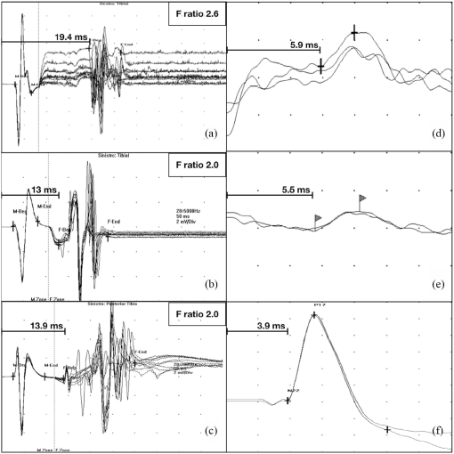 10.1177_2055116920906936-fig4.tif