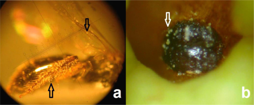 10.1177_194008291300600502-fig4.tif